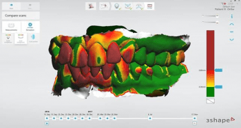 Dental-Sleep_Patient-Monitoring-Screenshot-upper-lower-350x187