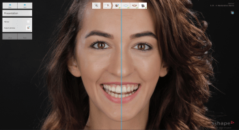 Smile-Design_software-screenshot-350x190